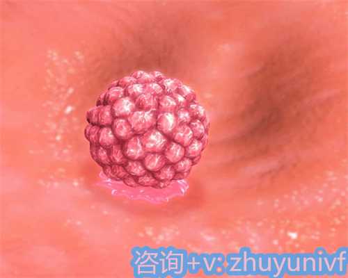 成都包生孩子，优势卵泡不破变成囊肿 卵泡不破成囊肿有危险