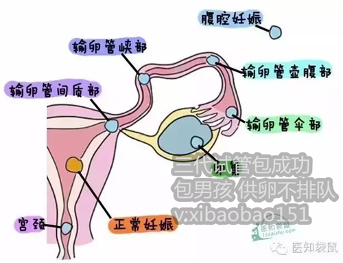 成都代怀孕那里最好,iui人工授精后多久可以验孕