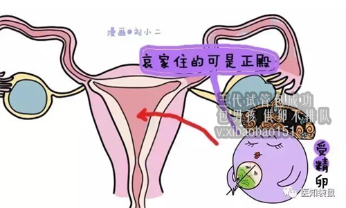 成都代怀机构有哪些,卵巢囊肿的症状